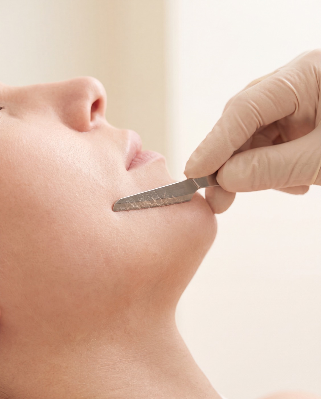Dermaplaning